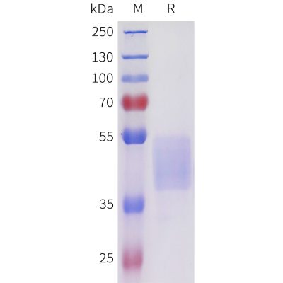 sp-pme101711 acvr2b sp1