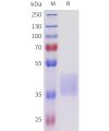 sp-pme101712 acvr2b sp1