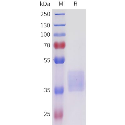 sp-pme101712 acvr2b sp1