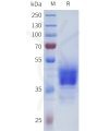 sp-pme101713 par1 sp1