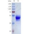sp-pme101714 oprk sp1