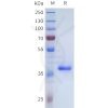 sp-pme101715 tgfb3 sp1