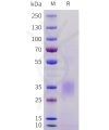 sp-pme101716 acvr2a sp1