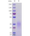 sp-pme101717 acvr2b sp1
