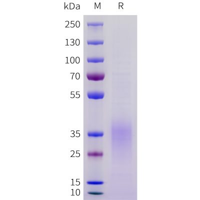 sp-pme101717 acvr2b sp1