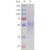 sp-pme101718 nptx2 sp1