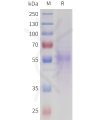 sp-pme101718 nptx2 sp1