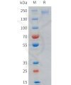 sp-pme101719 lrp6 sp1