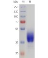 sp-pme101721 drd2 sp1