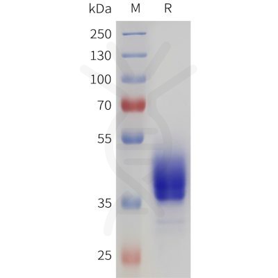 sp-pme101721 drd2 sp1