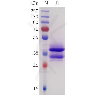 sp-pme101730 sez6 sp1