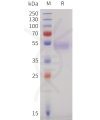 sp-pme101732 ighe sp1 1