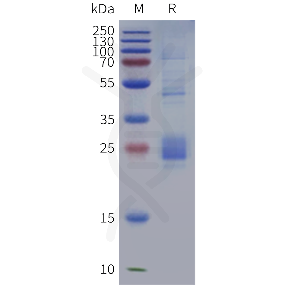 pme101733b-il33-sp1.png
