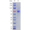 sp-pme101735 lilra4 sp1 1