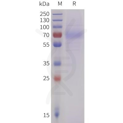 sp-pme101736 lilra4 sp1 1