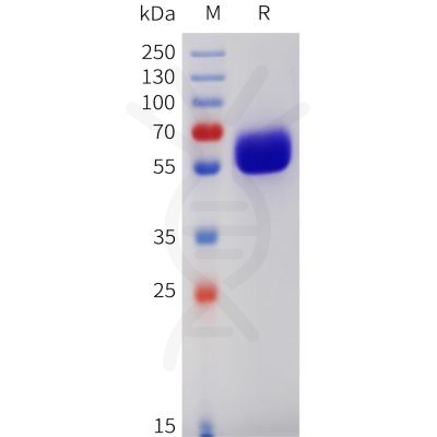 sp-pme101742 csf2rb sp1