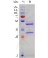 sp-pme101746 vegfc sp1