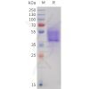 sp-pme101747 cb1 sp1 1