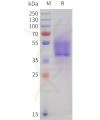 sp-pme101747 cb1 sp1 1
