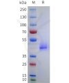 sp-pme101751 anxa2 sp1