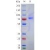 sp-pme101752 epha10 sp1