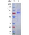 sp-pme101752 epha10 sp1