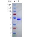sp-pme101755 nppa sp1