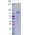 sp-pme101758 erbb4 sp1