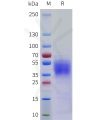 sp-pme101761 cd58 sp1