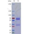 sp-pme101764 procr sp1