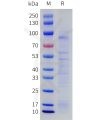 sp-pme101766 netrin 1 sp1