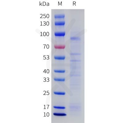 sp-pme101766 netrin 1 sp1