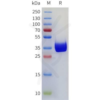 sp-pme101771 cd117 sp1