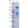 sp-pme101773 bai1 sp1