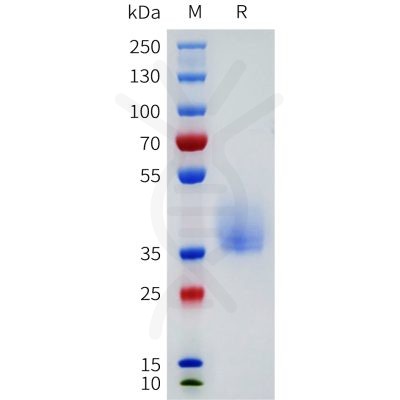 sp-pme101776 or52d1 sp1
