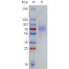 sp-pme101786 lilrb1 sp1