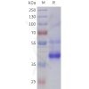 sp-pme101793 tgfb2 sp1