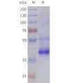 sp-pme101793 tgfb2 sp1