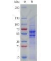 sp-pme101794 vegfb sp1