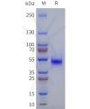 sp-pme101800 adrb3 sp1