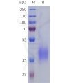 sp-pme101803 lilra5 sp1