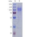 sp-pme101804 lrrc4 sp1