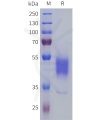 sp-pme101806 prokr2 sp1