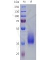sp-pme101808 ptgfr sp1
