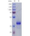 sp-pme101809 s1pr5 sp1