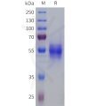 sp-pme101811 sstr1 sp1