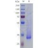 sp-pme101813 tas2r38 sp1