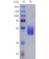 sp-pme101815 vipr2 sp1