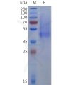 sp-pme101816 dcn sp1