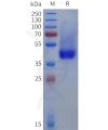 sp-pme101817 dcn sp1